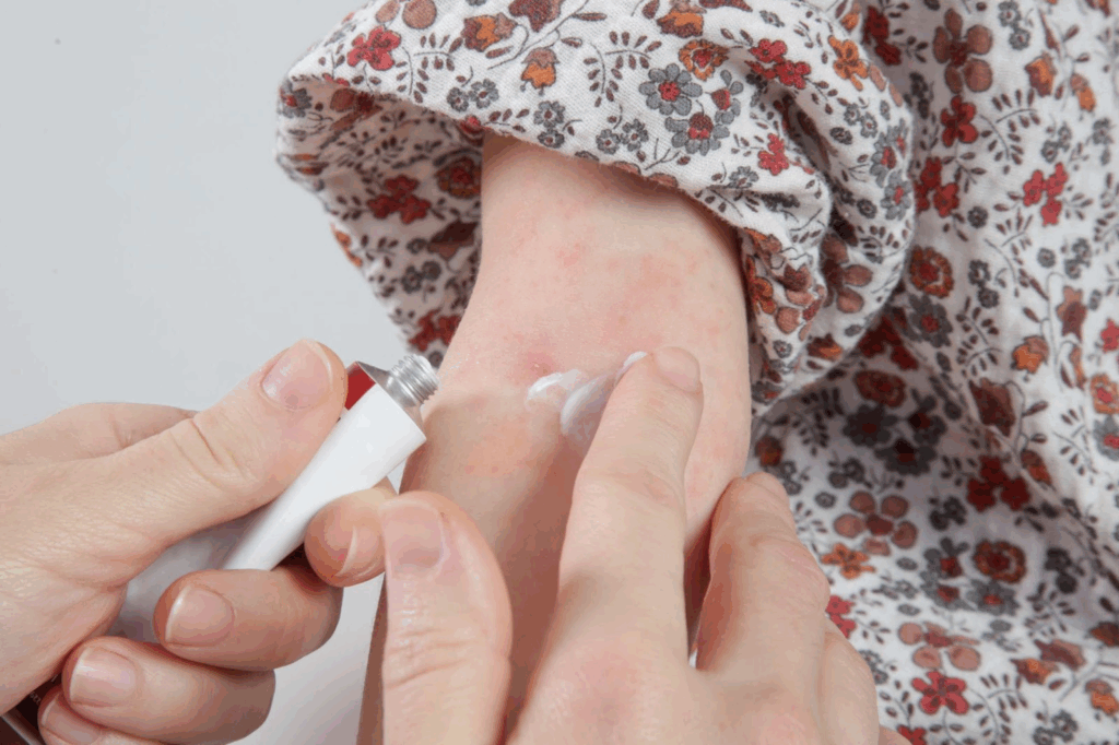 アトピーのお薬は何を選ぶ？タイプ別選び方とみんなのリアルな体験談