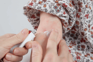 アトピーのお薬は何を選ぶ？タイプ別選び方とみんなのリアルな体験談