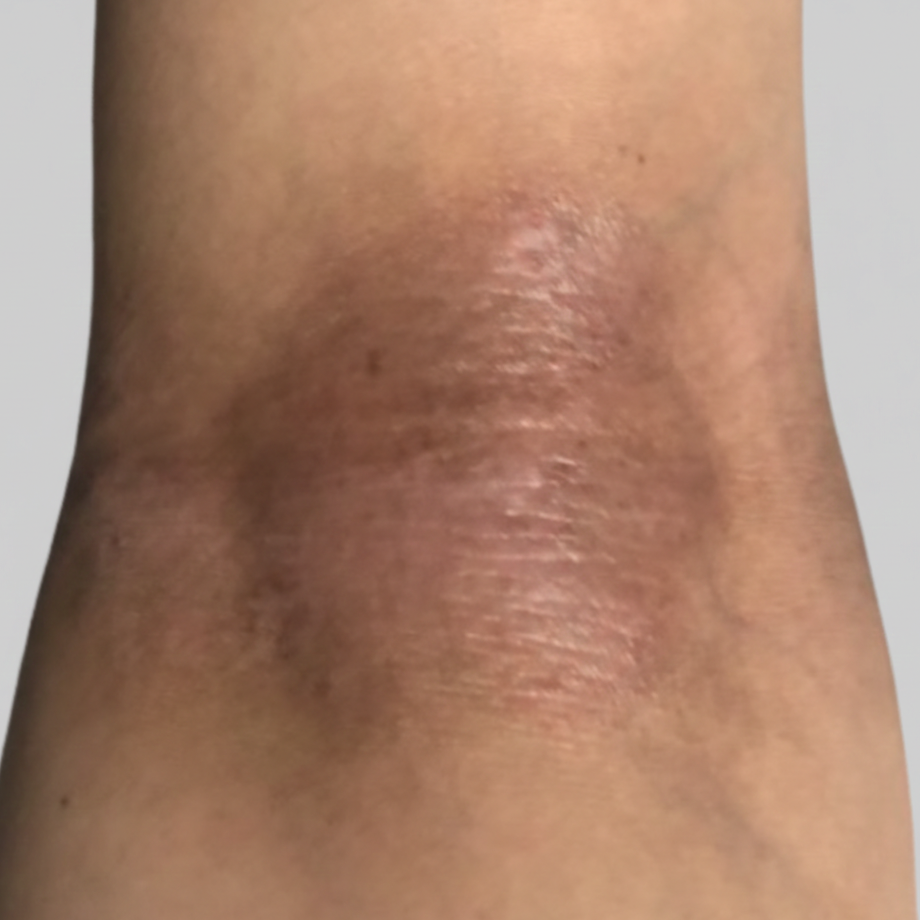 ストレスによって特に悪化しやすい部位