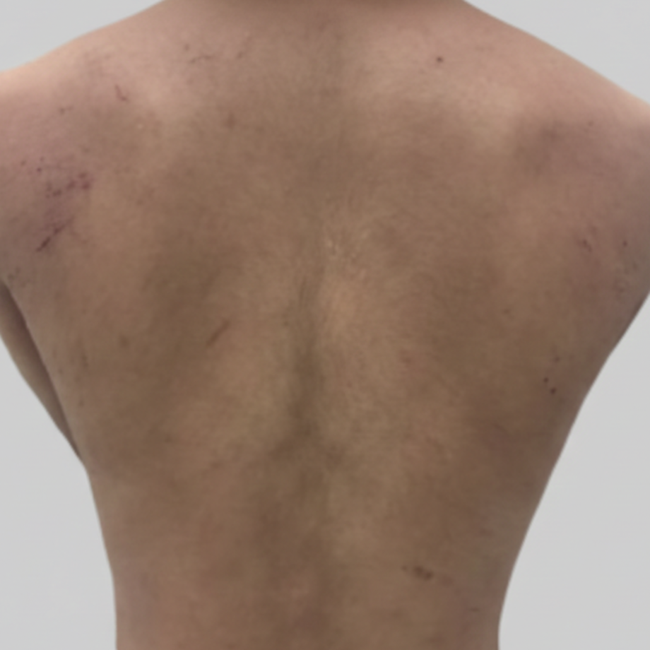 ストレスによって特に悪化しやすい部位