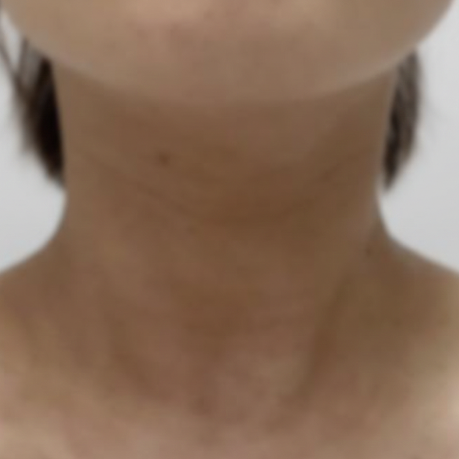 ストレスによって特に悪化しやすい部位